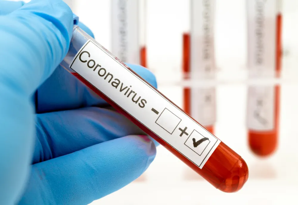 Numărul persoanelor infectate cu coronavirus în România a ajuns la 16.002. Situația pe județe actualizată