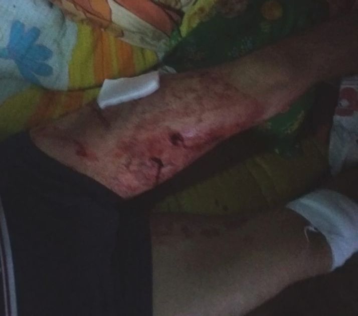 Bărbat atacat de urs la Boroşneu