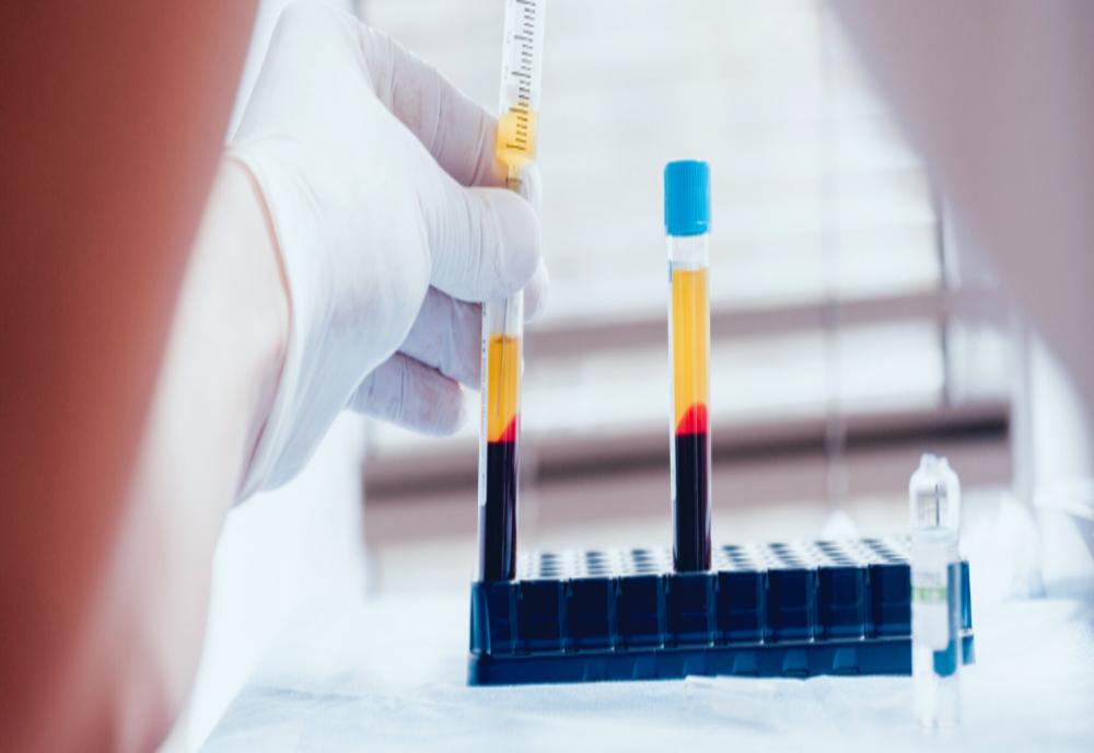 Aproape 2.680 de teste Covid-19 prelucrate în județul Covasna