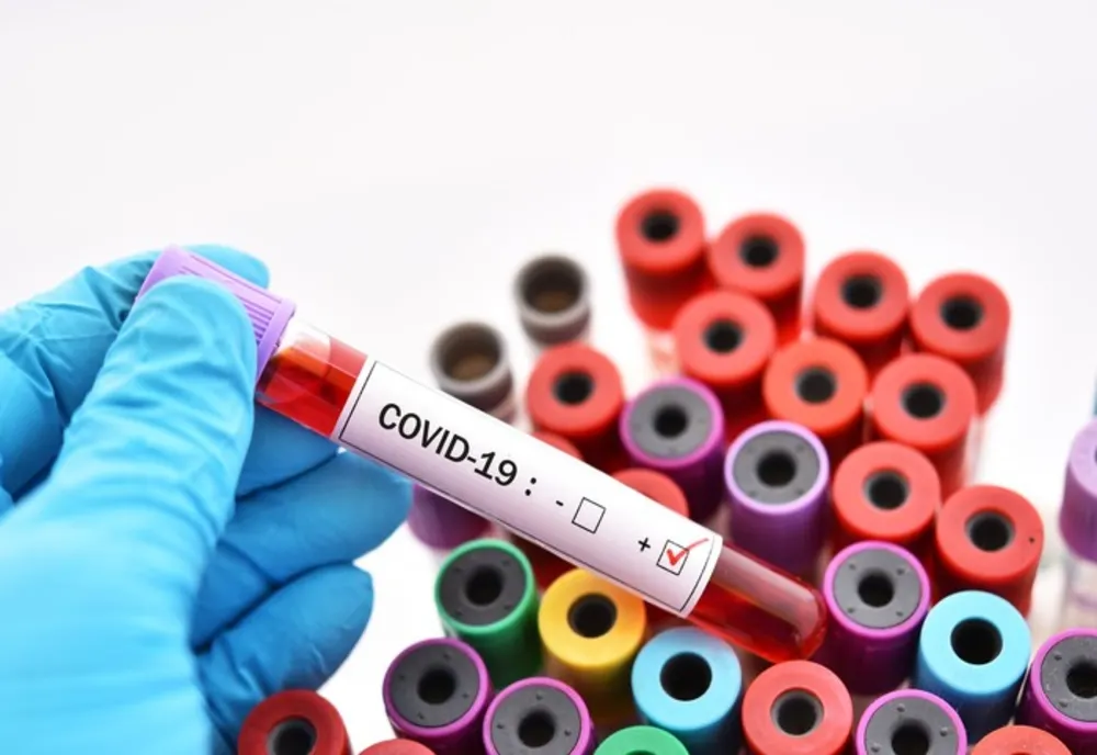 43 de persoane monitorizate la domiciliu. Nu sunt cazuri suspecte de coronavirus