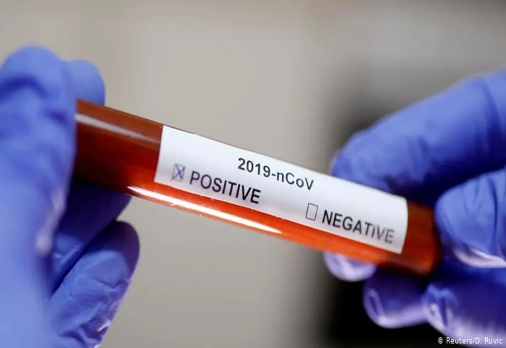 Încă un covăsnean testat pozitiv pentru coronavirus. Bilanţul îmbolnăvirilor ajunge la 124