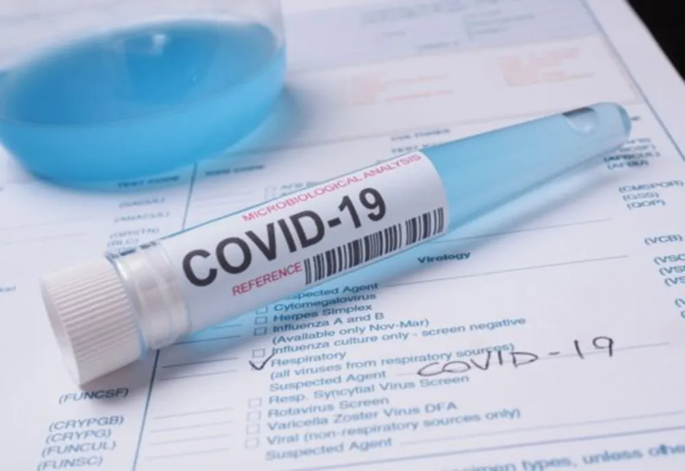 325 de cazuri noi la nivel național, dintre care 3 în județul Covasna. GCS: „Raportarea este parțială necuprinzând datele de la 12 laboratoare”